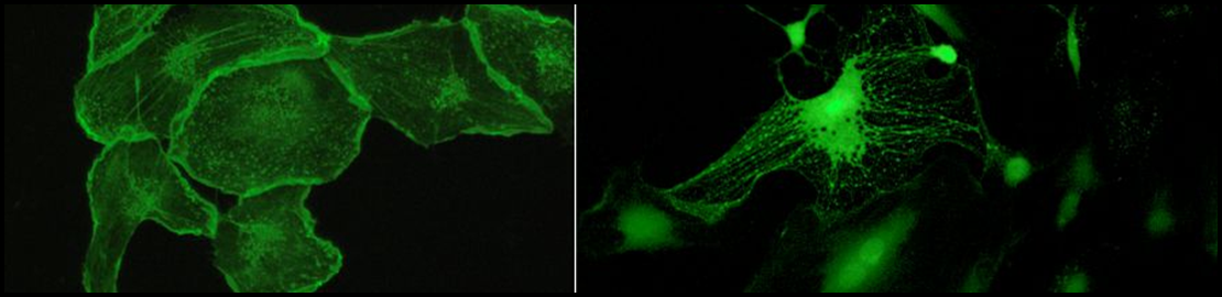 Depolimeryzowane włókna F-aktyn komórek śródbłonka (po lewej) oraz wybarwienie wapniem pojedynczej komórki śródbłonka (po prawej)