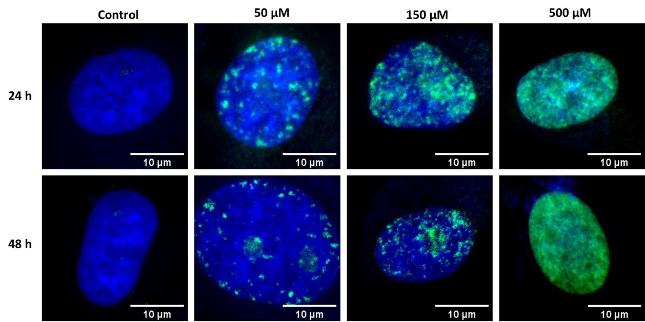 Fluorescence image of HeLa cells treated with various bleomycin concentrations after two different incubation times. DAPI was used to visualize cell nuclei (blue), and Alexa Fluor 488-tagged antibodies to observe γ-histone H2A.X.