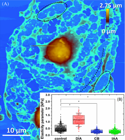 AFM image showing glutaraldehyde-fixed LSECs after 30 minutes treatment with a cytoskeletal-altering drug – cytochalasin B (CB) (21 μM). A) Bulging nucleus area is coloured in brown-orange. B) In the inset the results on elasticity parameter determination by means of AFM-tip nanoindentation in the nucleus area are shown. Changes in elasticity due to various drug treatments (diamide (DIA), 3-Indoleacetic acid (IAA), and CB) are apparent. Extracted from Zapotoczny B. et al. , Traffic, 2019