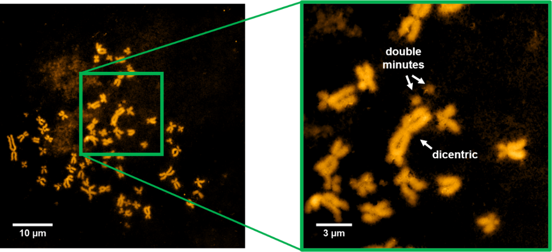 Obrazy AFM chromosomów wyizolowanych z komórek nowotworowych HeLa inkubowanych z bleomycyną.